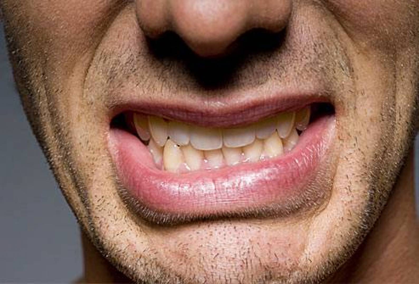 Бруксизм скрежетание зубами