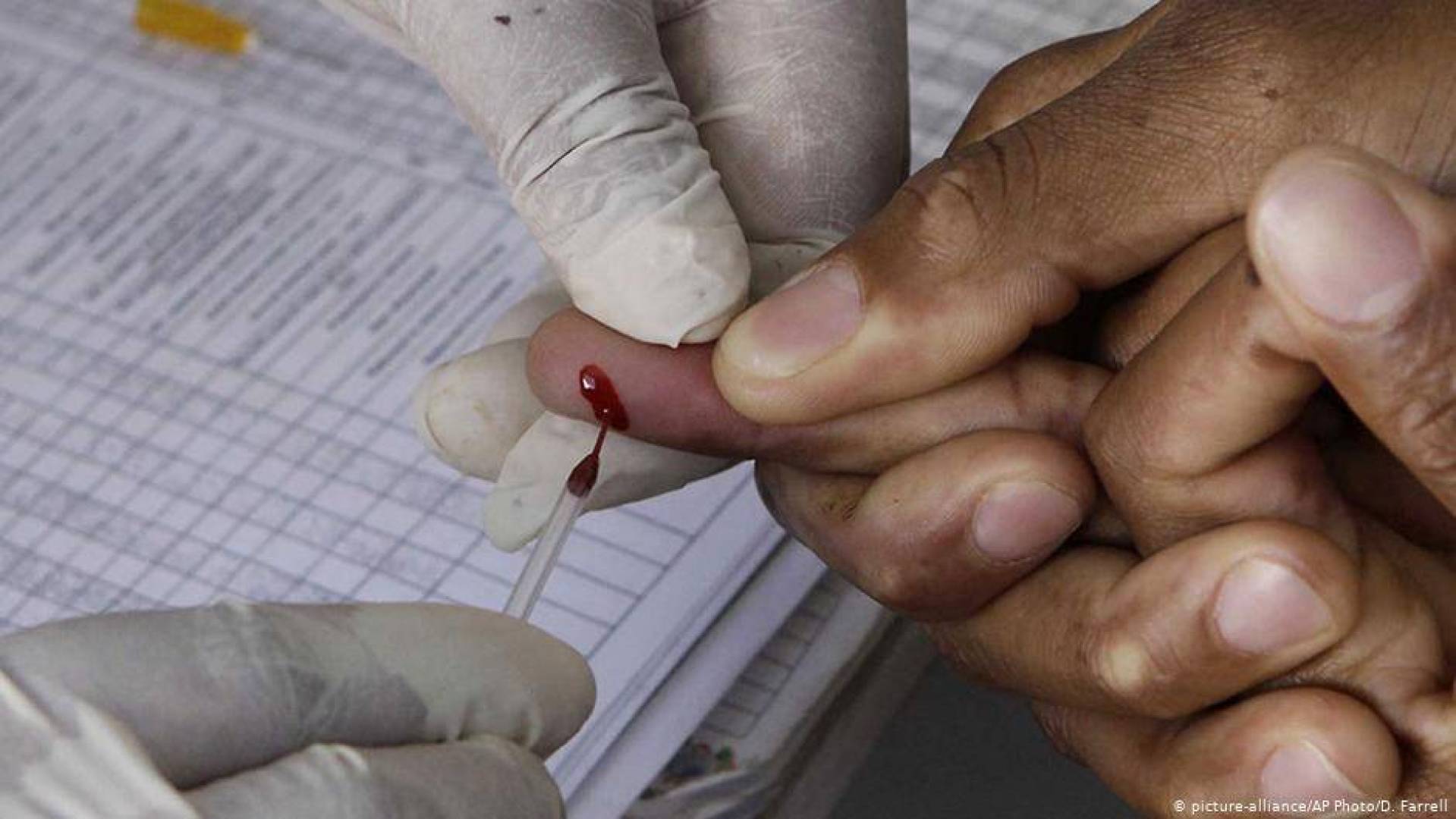دراسة حديثة قد تتوصل لعلاج عدوى الفيروس المناعي المكتسب الإيدز