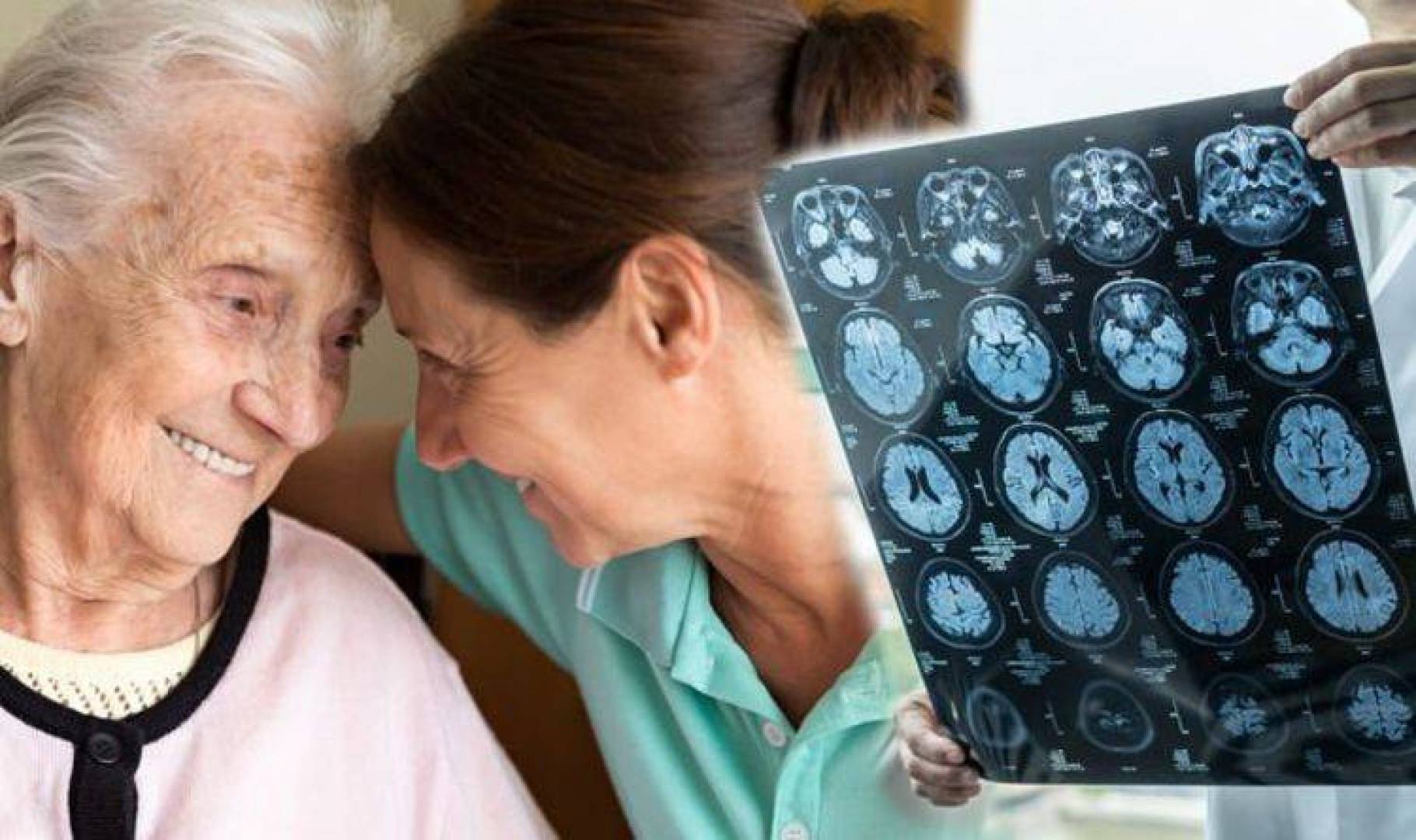 فقدان الذاكرة علامة رئيسية للخرف وبهذه الطرق يمكن الوقاية منه