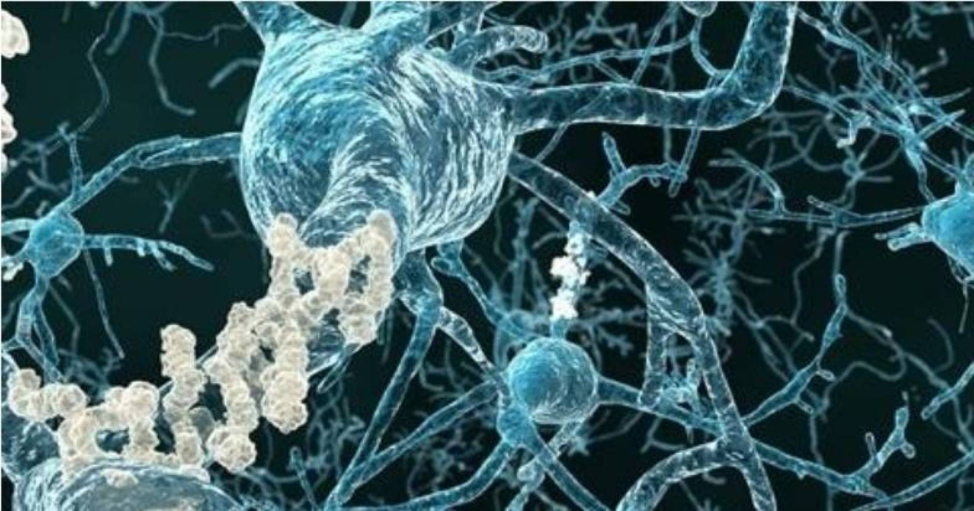 دراسة تجد انخفاضاً مفاجئاً في انتشار ضعف الإدراك بين كبار السن
