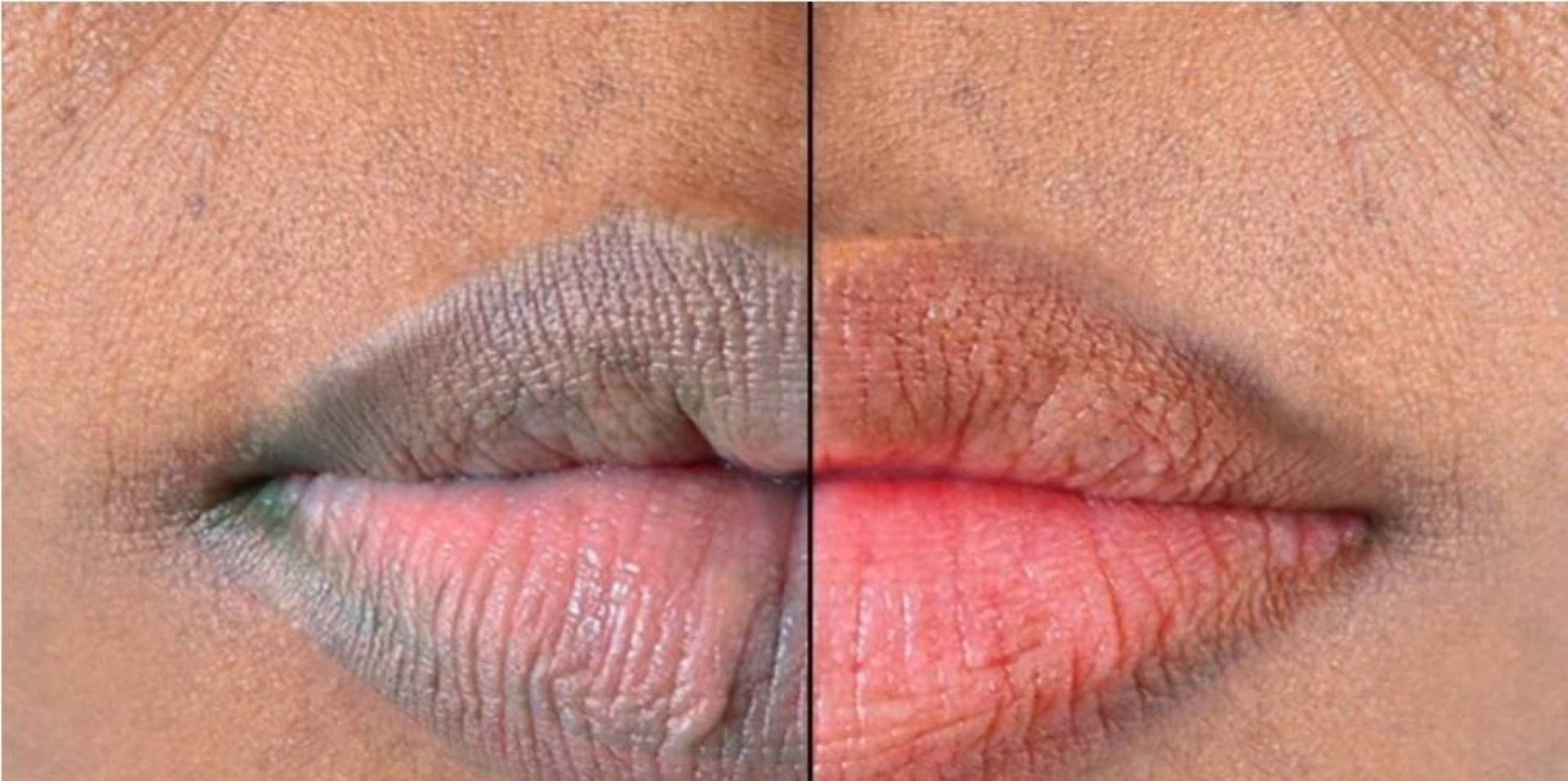 خمس طرق طبيعية لجعل شفتيك ناعمة وزهرية على رأسها 