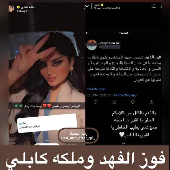 فوز الفهد قبل عملية التجميل