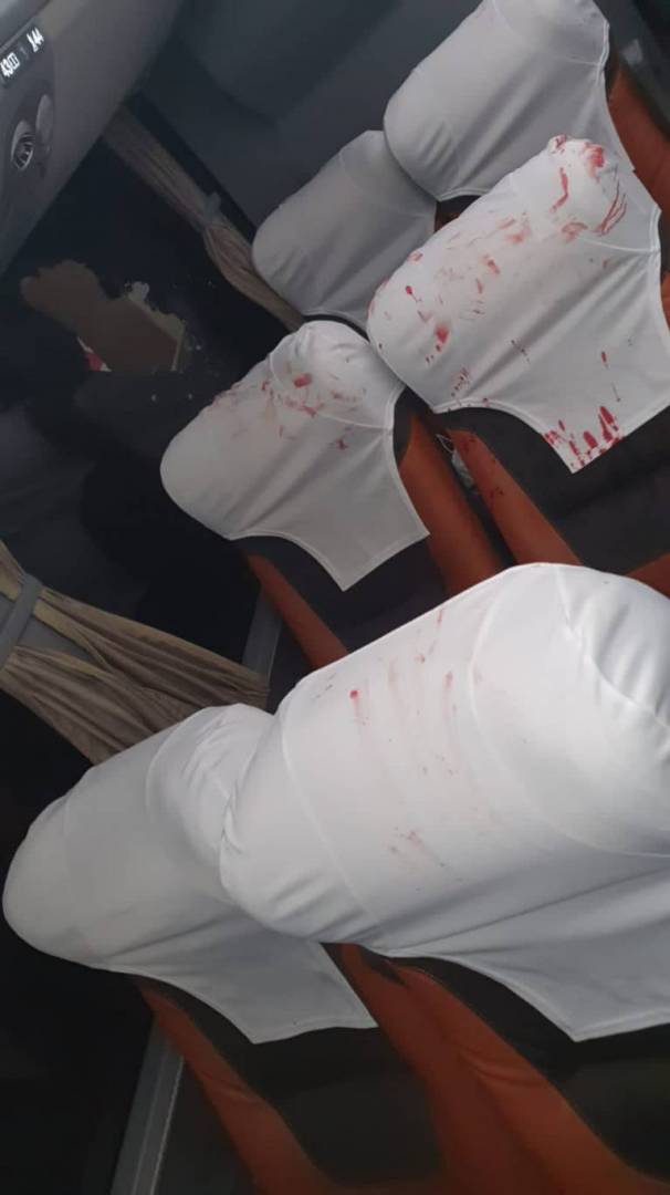 إصابة ثلاث لاعبين برازيليين بانفجار عبوة ناسفة بحافلة نادي باهيا البرازيلي