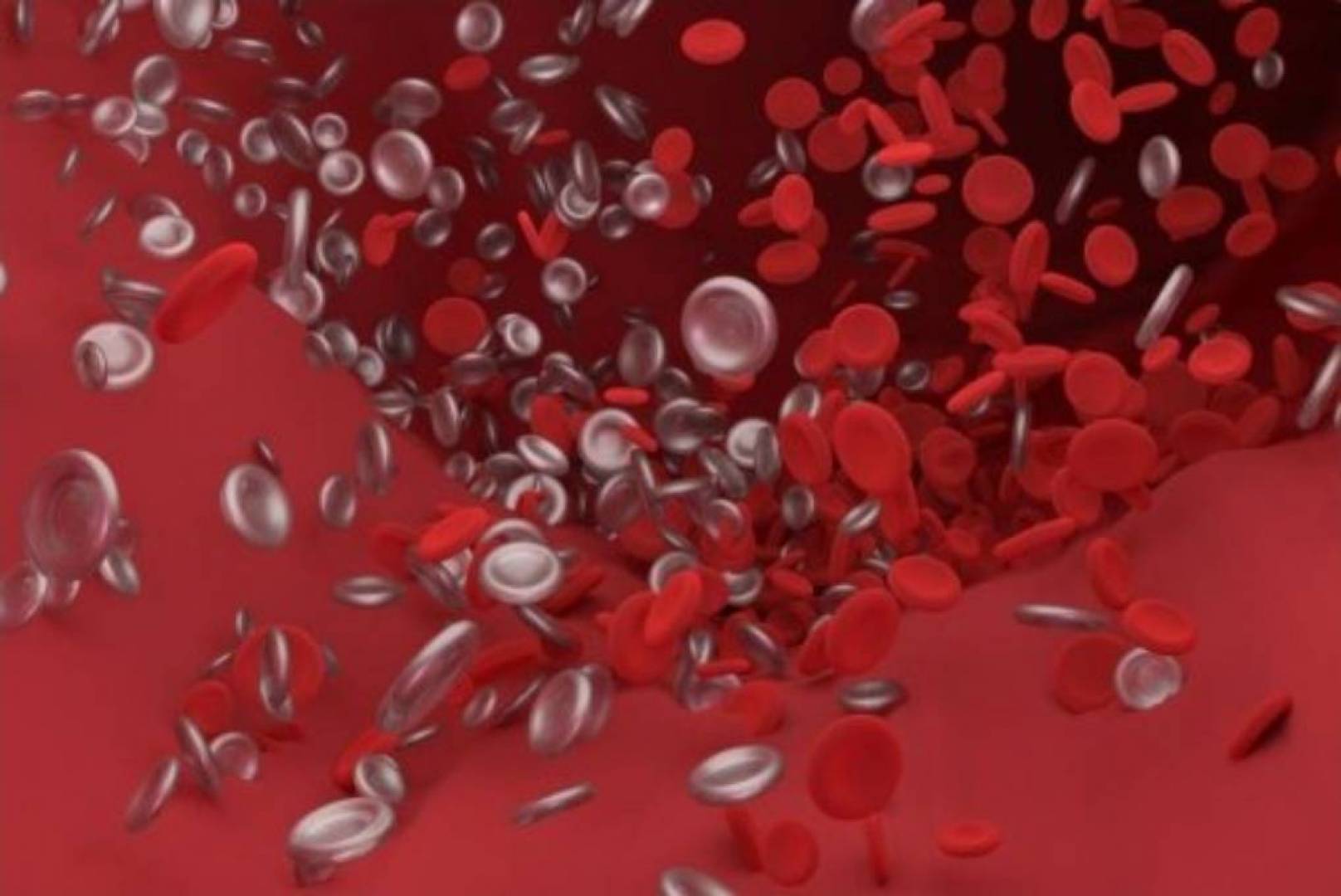 الأجسام المضادة الشاذة قد تسبب جلطات دموية عند الإصابة بفيروس كورونا