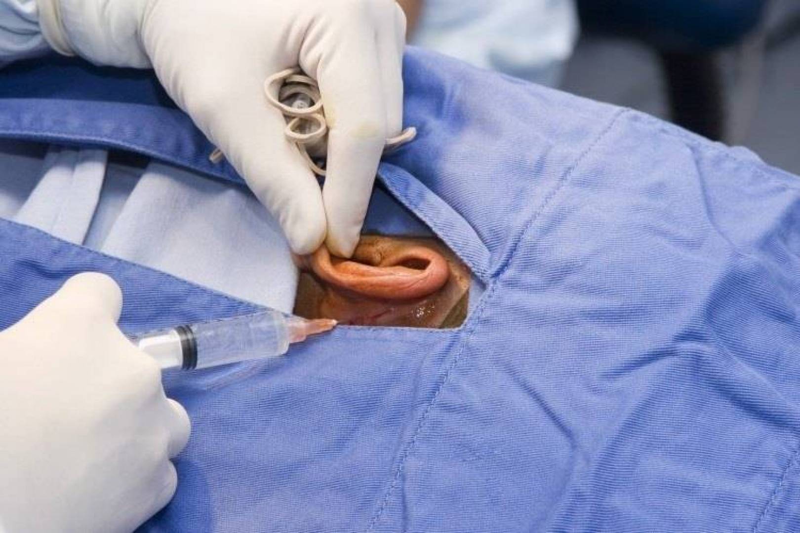 نجاح زراعة أول أذن بشرية مزروعة في المختبر