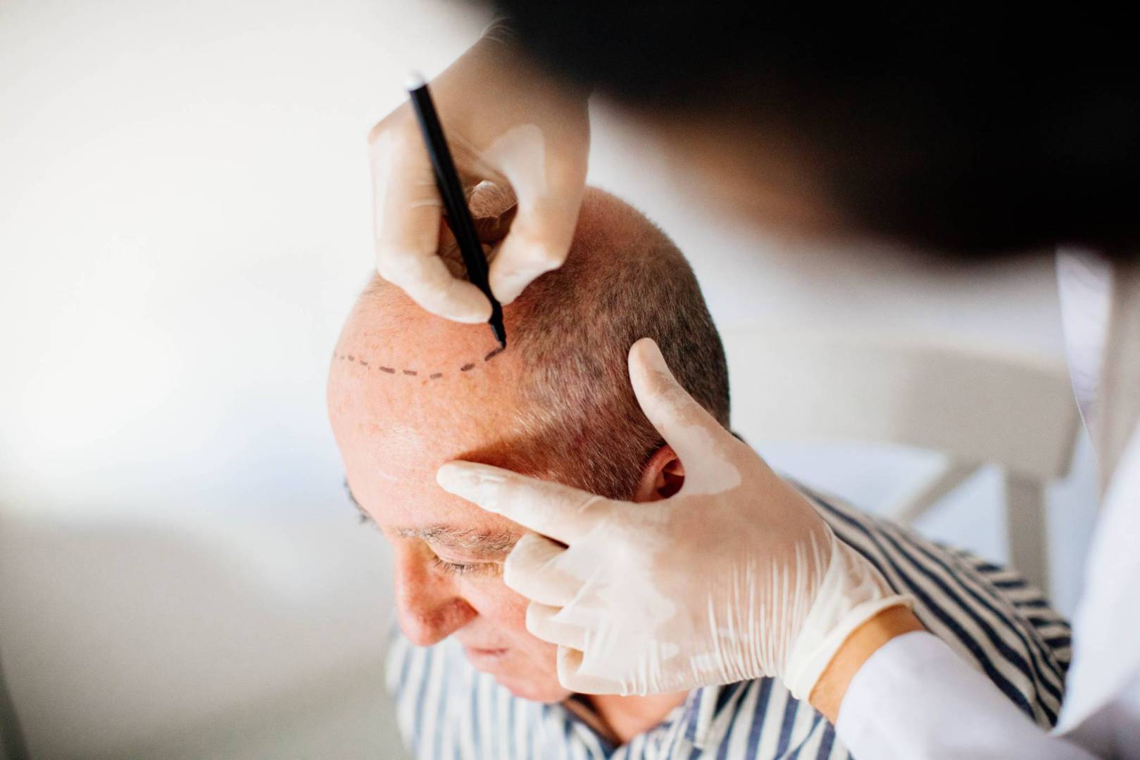 Lovest clinic المركز الأفضل لزراعة الشعر في تركيا