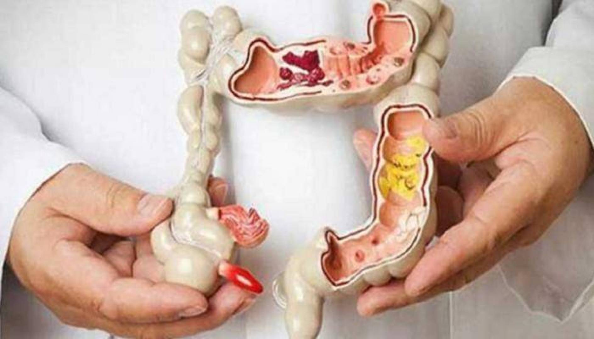 أمل جديد لمرضى السرطان مزيج دوائي ثلاثي يحدث فرقا كبيرا في البقاء