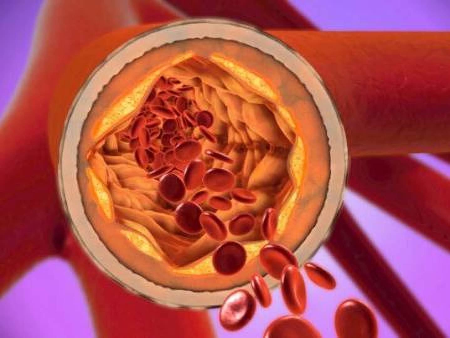 بروتين واحد أدق من الكوليسترول في التنبؤ بأمراض القلب | النهضة نيوز