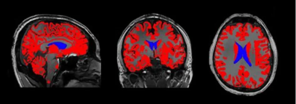 تأثير فيروس كوفيد-19 على الدماغ  ( مصدر الصورة: Eurekalert.org )