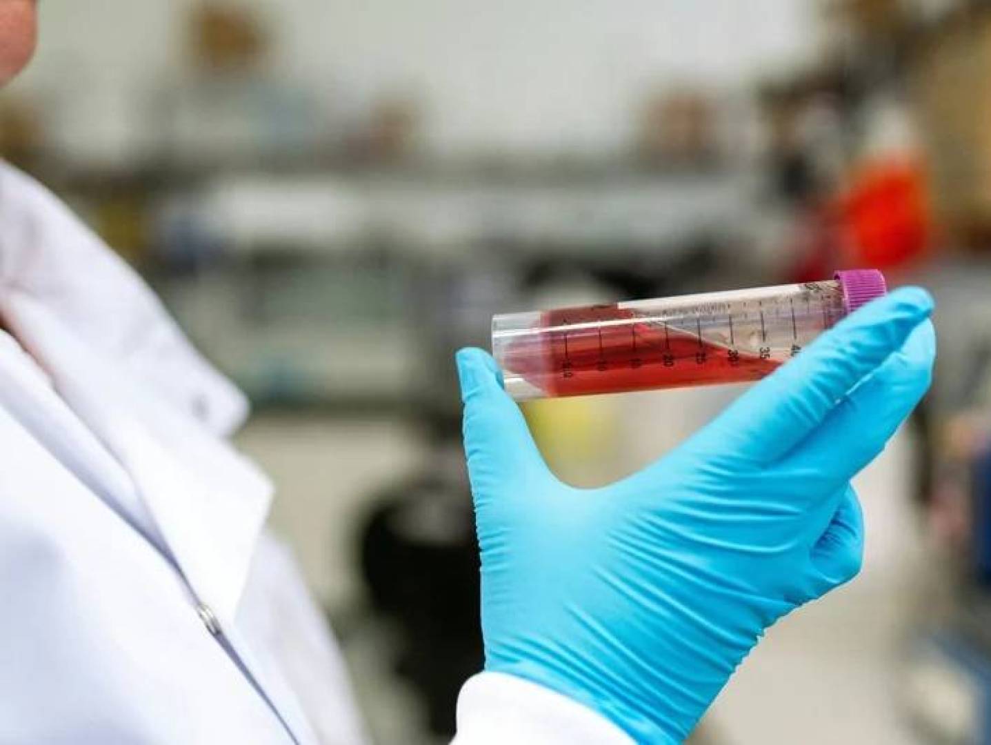 New Blood Test Detects 50+ Cancers Early