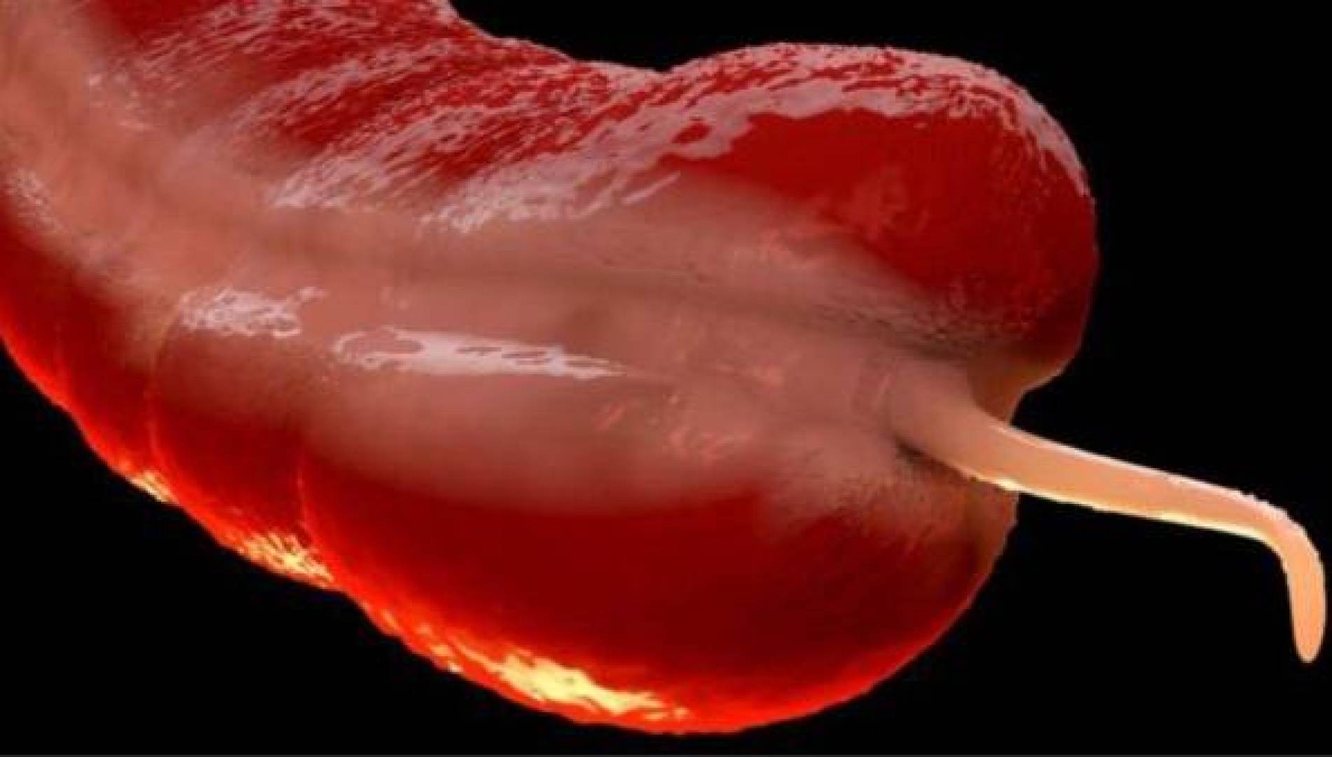 سرطان نادر يتصاعد بين الشباب بشكل مقلق والعلماء لا يعرفون السبب | النهضة نيوز