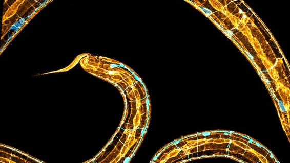 دراسة ديدان مجهرية مستديرة ( مصدر الصورة: جامعة كوينزلاند )