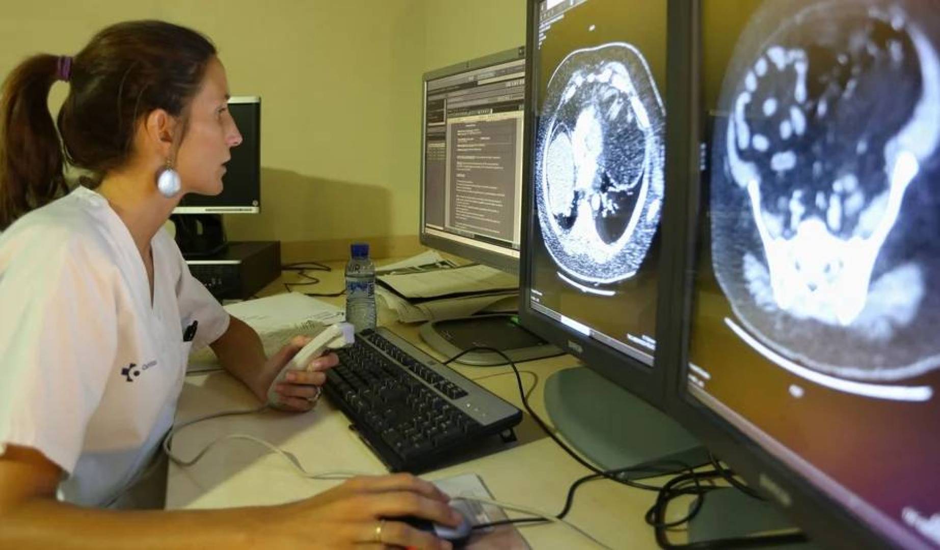 تصوير ثلاثي الأبعاد للجسم يتجاوز قيود الرنين المغناطيسي والتصوير المقطعي | النهضة نيوز