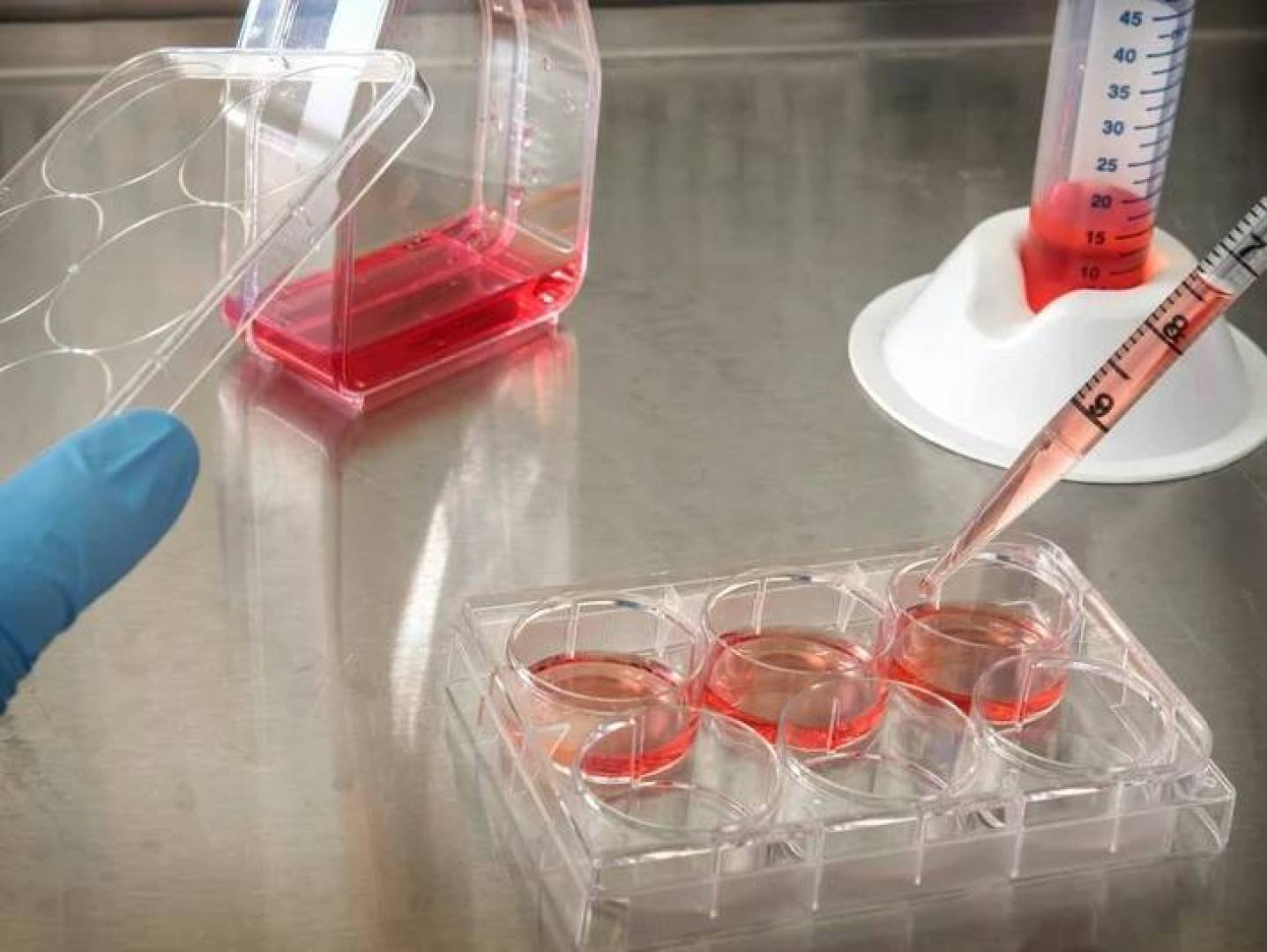 تغيّرات البنكرياس الناتجة عن مرض السكري من النوع الأول | النهضة نيوز