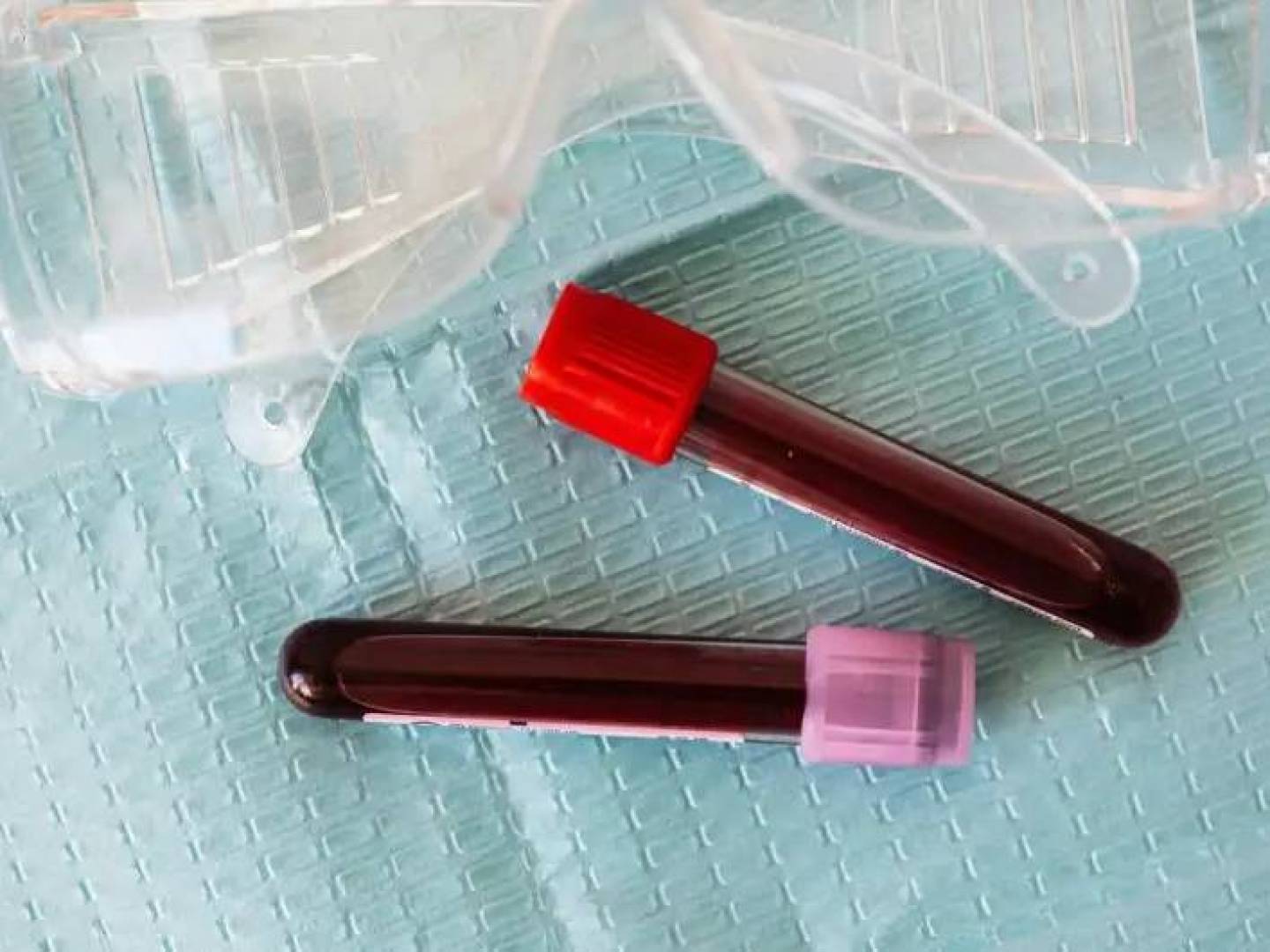 علامة دماغية جديدة في الدم تساعد على متابعة إصابة الدماغ بعد السكتة الدماغية | النهضة نيوز