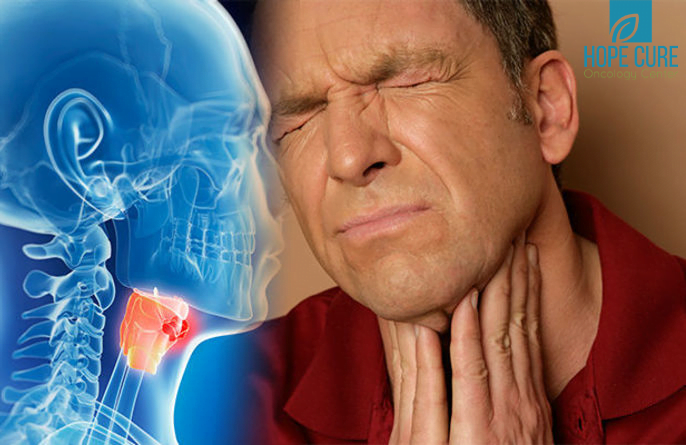 تشخيص سرطان الحنجرة ( مصدر الصورة: sciencedaily )