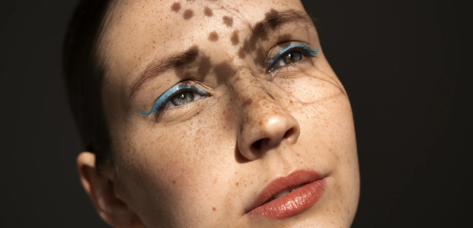 الوقاية من الكلف وعلاجه ( مصدر الصورة: Freepik )