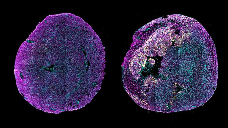 علاج مبتكر يحفّز القلب على الشفاء ( مصدر الصورة: جامعة كولومبيا ) 