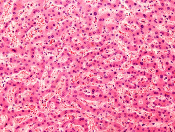 تأثير الفضاء على صحة الكبد ( مصدر الصورة: Freepik )