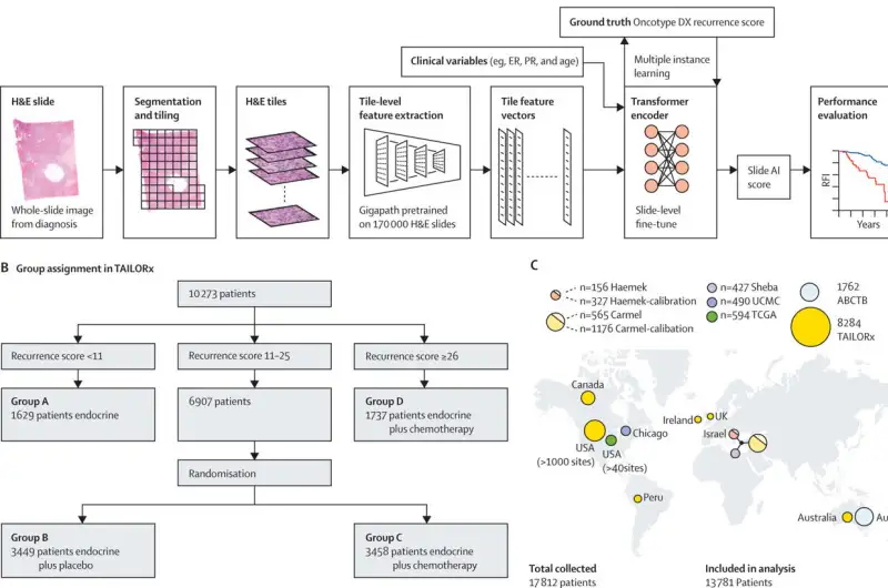 التنبؤ بمدى استفادة مرضى سرطان الثدي من العلاج الكيميائي ( مصدر الصورة: معهد التخنيون )