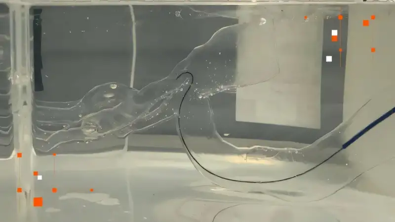 إزالة الجلطات الدماغية في بيئة مختبرية فعلية ( مصدر الصورة: King's College London )