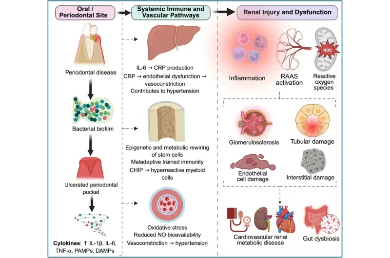علاقة متبادلة بين أمراض اللثة وأمراض الكلى المزمنة ( مصدر الصورة: BMC Nephrology )