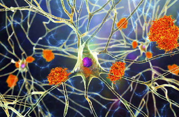 تعافي الأعصاب بعد الإصابة ( مصدر الصورة: Stock )