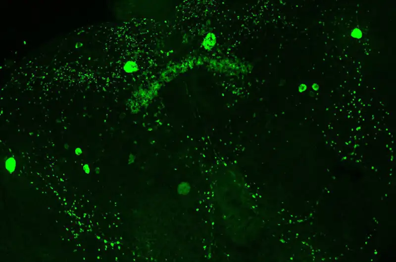 الدماغ والهزال السرطاني ( مصدر الصورة: جامعة هارفارد )