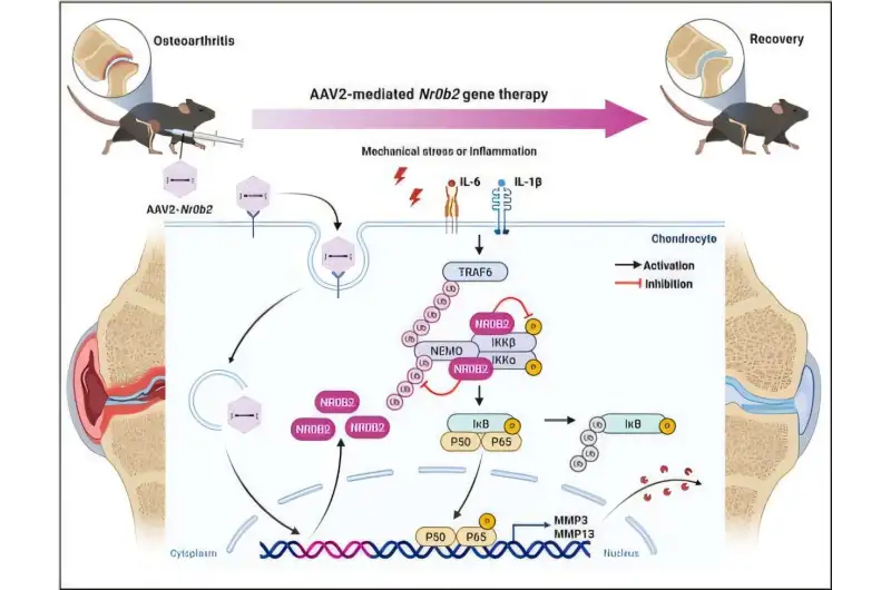 خشونة المفاصل ( مصدر الصورة: Chungnam National University Hospital )