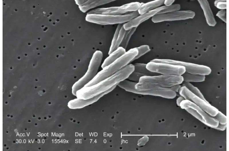 كشف السل النشط بدقة ( مصدر الصورة: UC Davis )