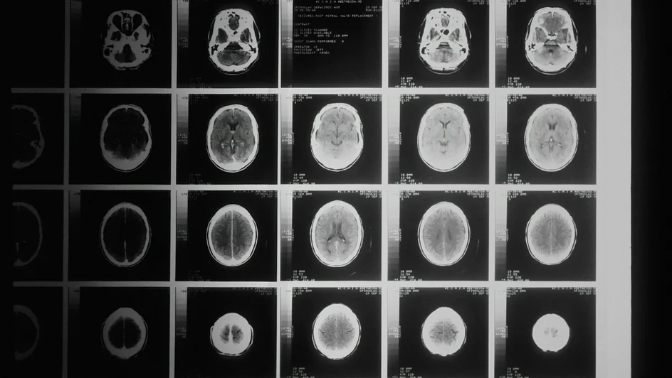تقنية متقدمة لتصوير أنسجة الدماغ بسرعة عالية ( مصدر الصورة: Massachusetts Institute of Technology )