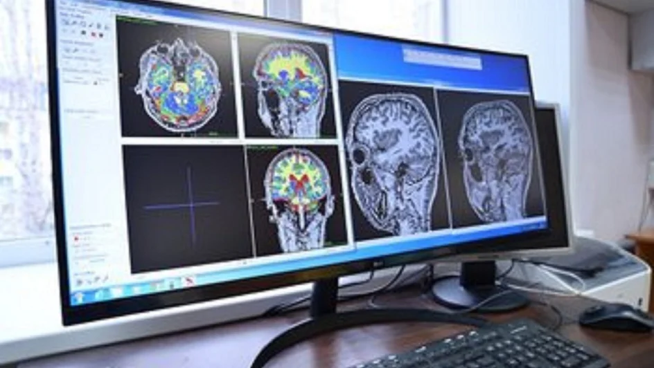 علاج أورام الدماغ باستخدام بخاخ أنفي ذكي ( مصدر الصورة: Sechenov University )
