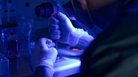 اختبارات مخبرية للحد من تطور سرطان الجلد ( مصدر الصورة: الجامعة العبرية في القدس )