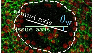 سرعة التئام بعض الجروح ( مصدر الصورة: جامعة بريستول )