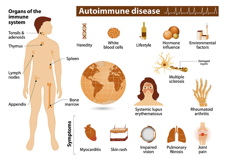 أمراض المناعة الذاتية ( مصدر الصورة: Garvan Institute of Medical Research )