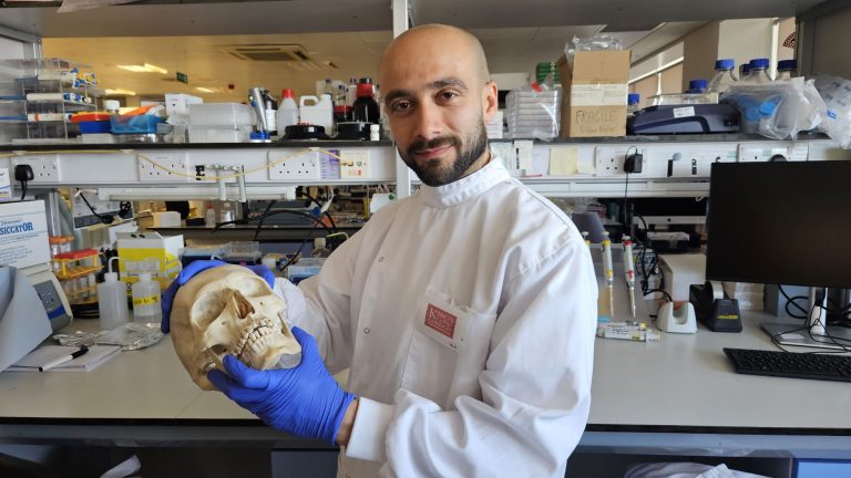 تجديد العظام ( مصدر الصورة: King's College London )