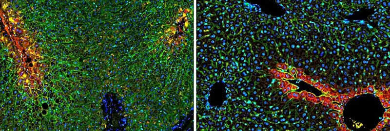 خريطة جينية عالية الدقة للكبد البشري ( مصدر الصورة: معهد وايزمان للعلوم )