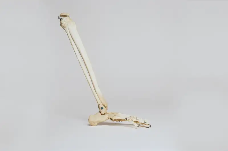 نقص كثافة العظام ( مصدر الصورة: Pixabay )