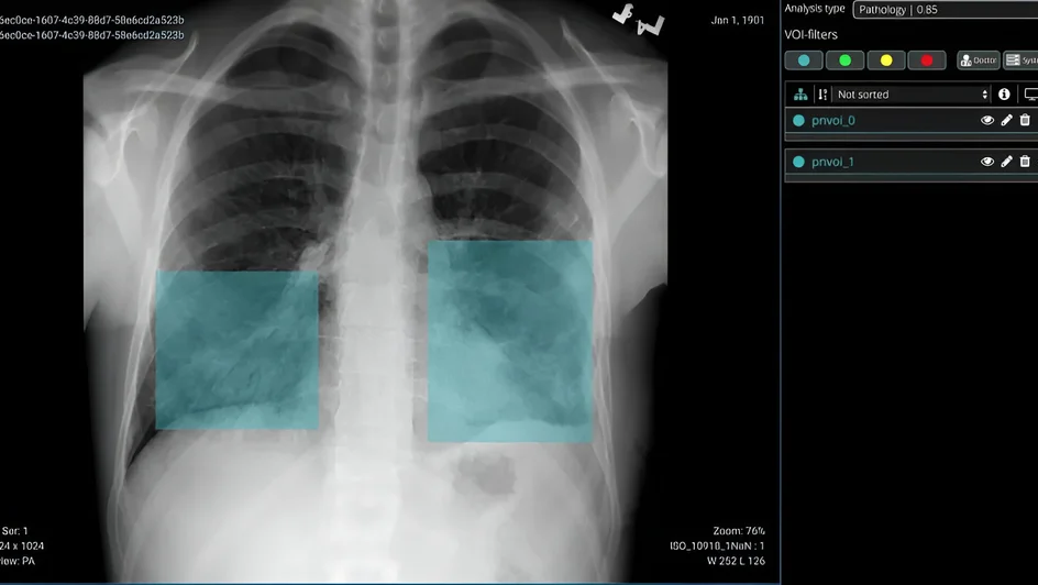 تشخيص طفرات سرطان الرئة ( مصدر الصورة: جامعة إدنبرة )