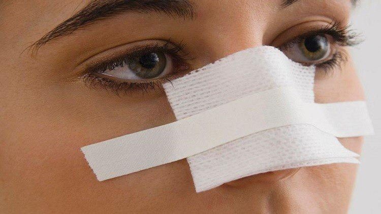العلم يتوصل إلى طريقة تجميل الانف خلال 5 دقائق دون جراحة