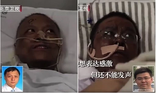 coronavirus-covid-19-doctors-china-black-skin.jpg